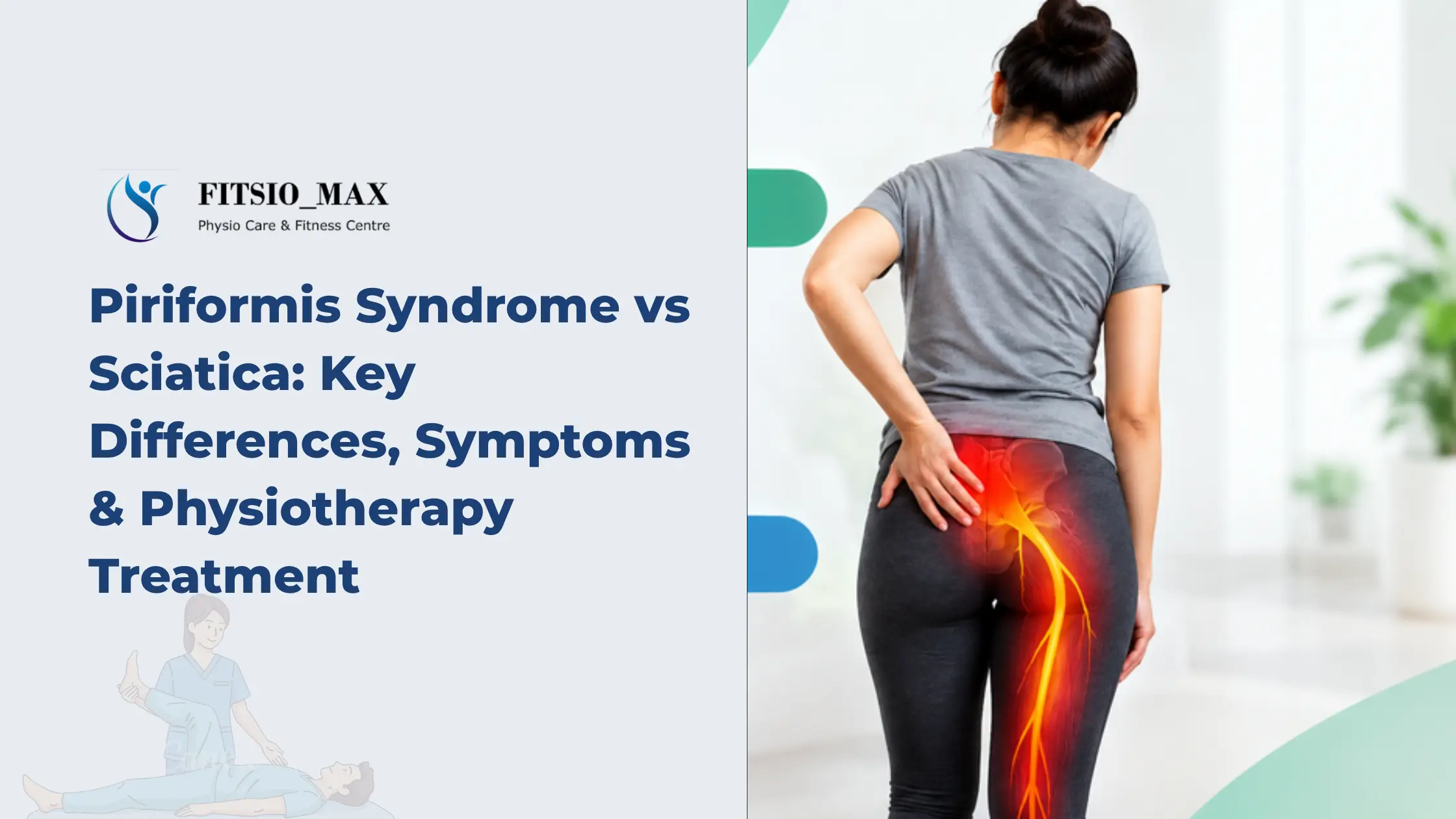 Piriformis syndrome vs sciatica